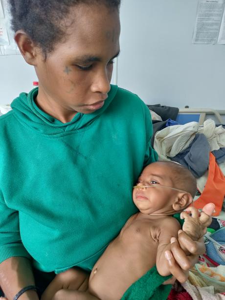 Bani receiving oxygen at the hospital2